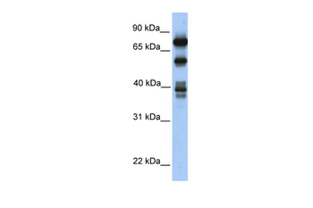STRBP Rabbit Polyclonal Antibody