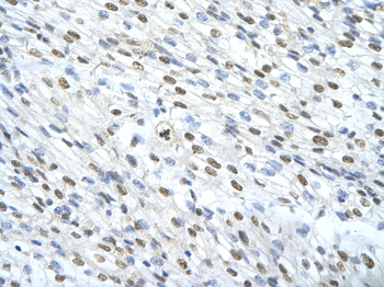 MATR3 Rabbit Polyclonal Antibody