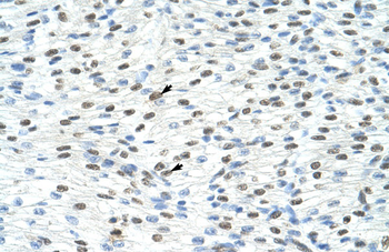 MATR3 Rabbit Polyclonal Antibody