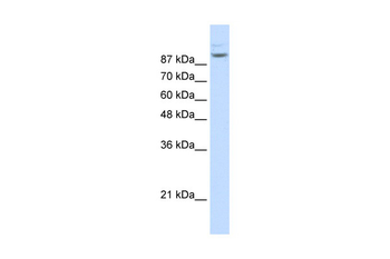 MATR3 Rabbit Polyclonal Antibody