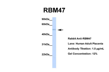 RBM47 Rabbit Polyclonal Antibody