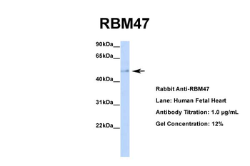 RBM47 Rabbit Polyclonal Antibody