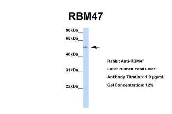RBM47 Rabbit Polyclonal Antibody