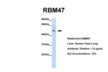 RBM47 Rabbit Polyclonal Antibody