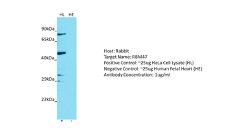 RBM47 Rabbit Polyclonal Antibody