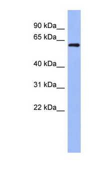 RBM47 Rabbit Polyclonal Antibody