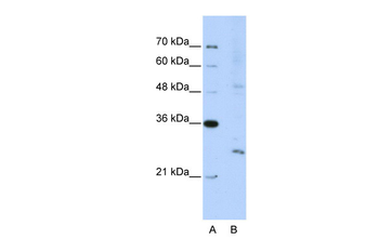 EXOSC4 Rabbit Polyclonal Antibody