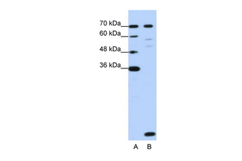 LSM2 Rabbit Polyclonal Antibody