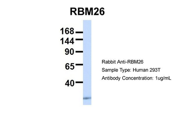 RBM26 Rabbit Polyclonal Antibody