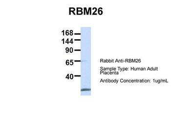 RBM26 Rabbit Polyclonal Antibody