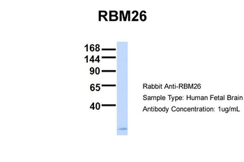 RBM26 Rabbit Polyclonal Antibody