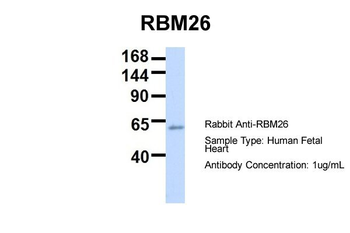 RBM26 Rabbit Polyclonal Antibody