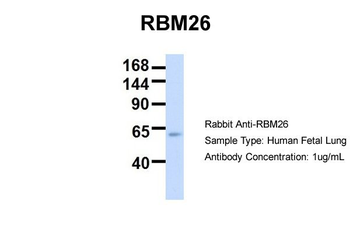 RBM26 Rabbit Polyclonal Antibody