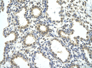 RBM26 Rabbit Polyclonal Antibody