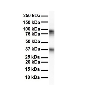 CPEB4 Rabbit Polyclonal Antibody