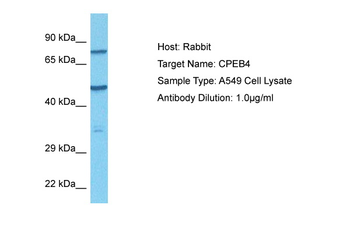 CPEB4 Rabbit Polyclonal Antibody