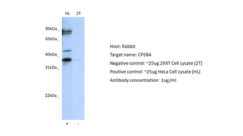 CPEB4 Rabbit Polyclonal Antibody