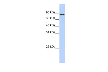 CPEB4 Rabbit Polyclonal Antibody