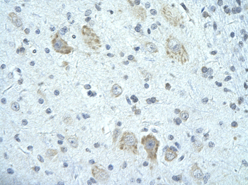 FIP1L1 Rabbit Polyclonal Antibody