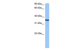 HNRNPA2B1 Rabbit Polyclonal Antibody