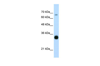 THOC3 Rabbit Polyclonal Antibody