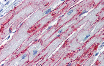 PNPT1 Rabbit Polyclonal Antibody