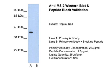 MSI2 Rabbit Polyclonal Antibody