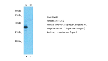 MSI2 Rabbit Polyclonal Antibody