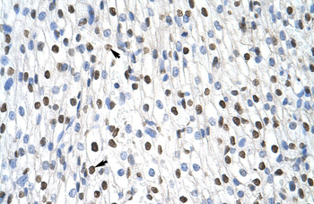 MSI2 Rabbit Polyclonal Antibody