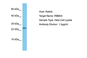 RBM24 Rabbit Polyclonal Antibody