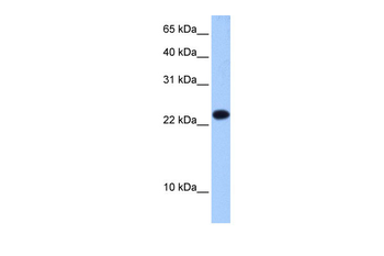 EIF4E3 Rabbit Polyclonal Antibody