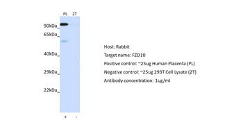 FZD10 Rabbit Polyclonal Antibody