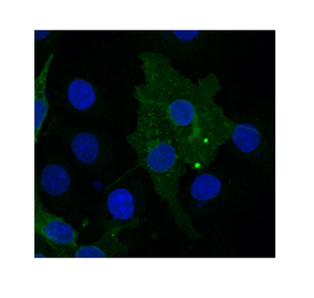 FZD10 Rabbit Polyclonal Antibody