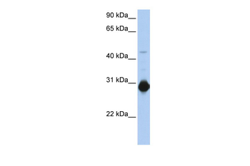 RHOU Rabbit Polyclonal Antibody