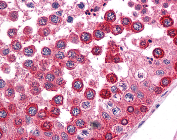 WNT2B Rabbit Polyclonal Antibody