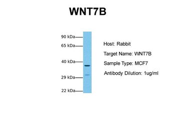 WNT7B Rabbit Polyclonal Antibody