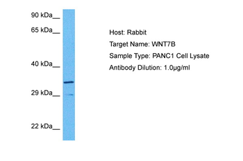 WNT7B Rabbit Polyclonal Antibody