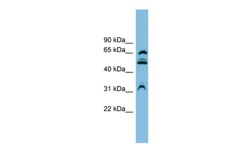 WDR1 Rabbit Polyclonal Antibody