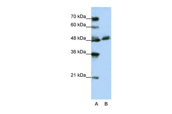 WDR13 Rabbit Polyclonal Antibody