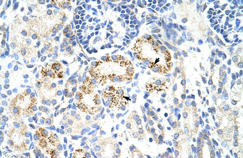 CDC25B Rabbit Polyclonal Antibody