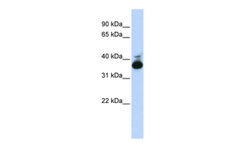 ALDOB Rabbit Polyclonal Antibody
