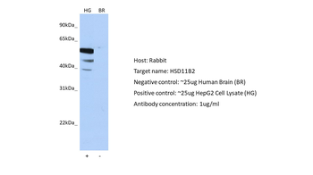 HSD11B2 Rabbit Polyclonal Antibody