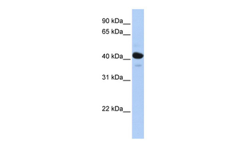 HSD11B2 Rabbit Polyclonal Antibody