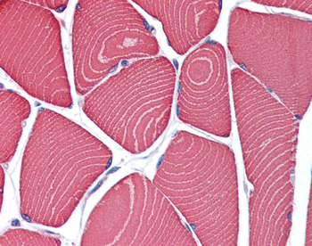 Myh7 Rabbit Polyclonal Antibody