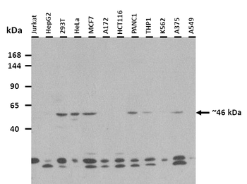 SLC12A1 Rabbit Polyclonal Antibody