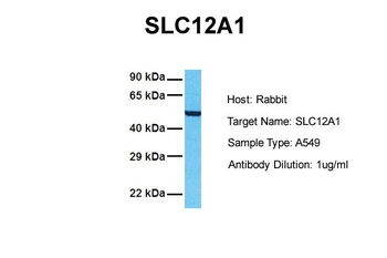 SLC12A1 Rabbit Polyclonal Antibody