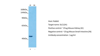 SLC12A1 Rabbit Polyclonal Antibody
