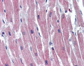 TNNI3 Rabbit Polyclonal Antibody