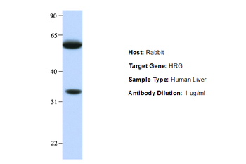 HRG Rabbit Polyclonal Antibody