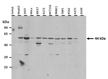 MAT1A Rabbit Polyclonal Antibody
